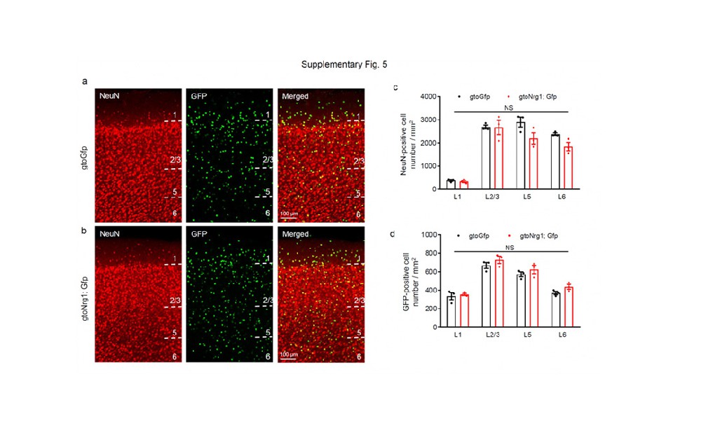 Nature Communications| 华东师范大学揭示精神分裂症大脑皮层去抑制的神经机制