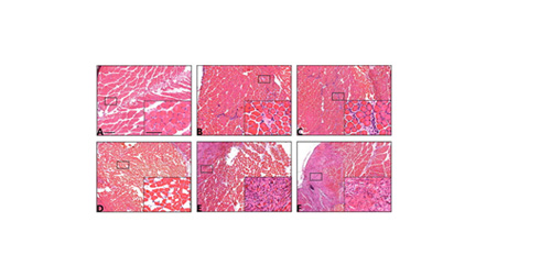 法医病理学：利用TissueFAXS系统精准识别大鼠挫伤性骨骼肌再生过程中性粒细胞